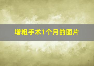 增粗手术1个月的图片