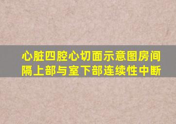 心脏四腔心切面示意图房间隔上部与室下部连续性中断