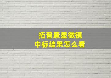 拓普康显微镜中标结果怎么看