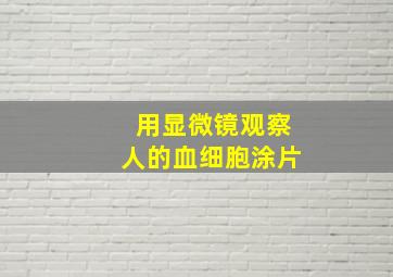 用显微镜观察人的血细胞涂片