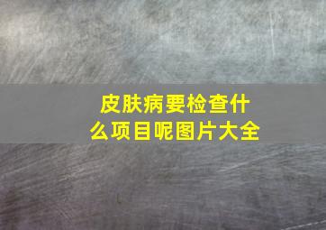 皮肤病要检查什么项目呢图片大全